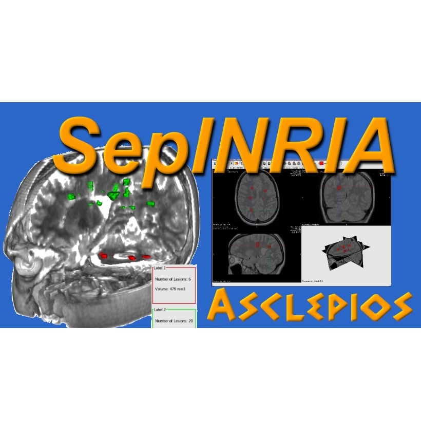 SepINRIA Multiple Sclerosis Software Logiciel Sclérose en Plaques Segmentation lesions